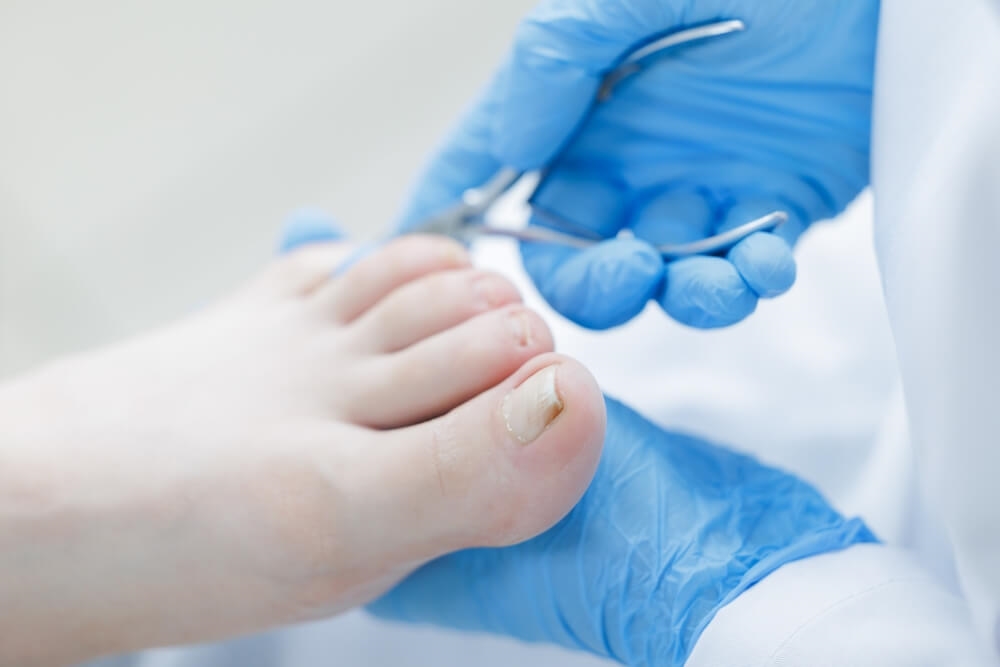 Pieds diabétiques : une surveillance essentielle