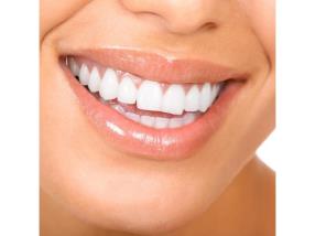 Blanchiment des dents