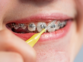 Orthodontie