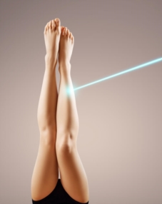 Epilation Laser