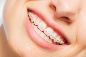 Orthodontie