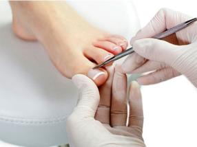 Pédicure médicale