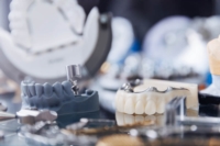 Artikel vonDental Weber (Laboratoire Dentaire)